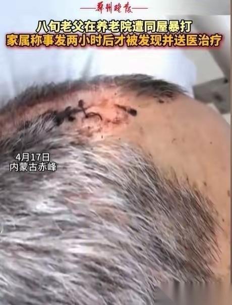 “必须严惩！”内蒙古赤峰，女子将父亲送到养老院，几天后去接，只见父亲裤子直接裂开