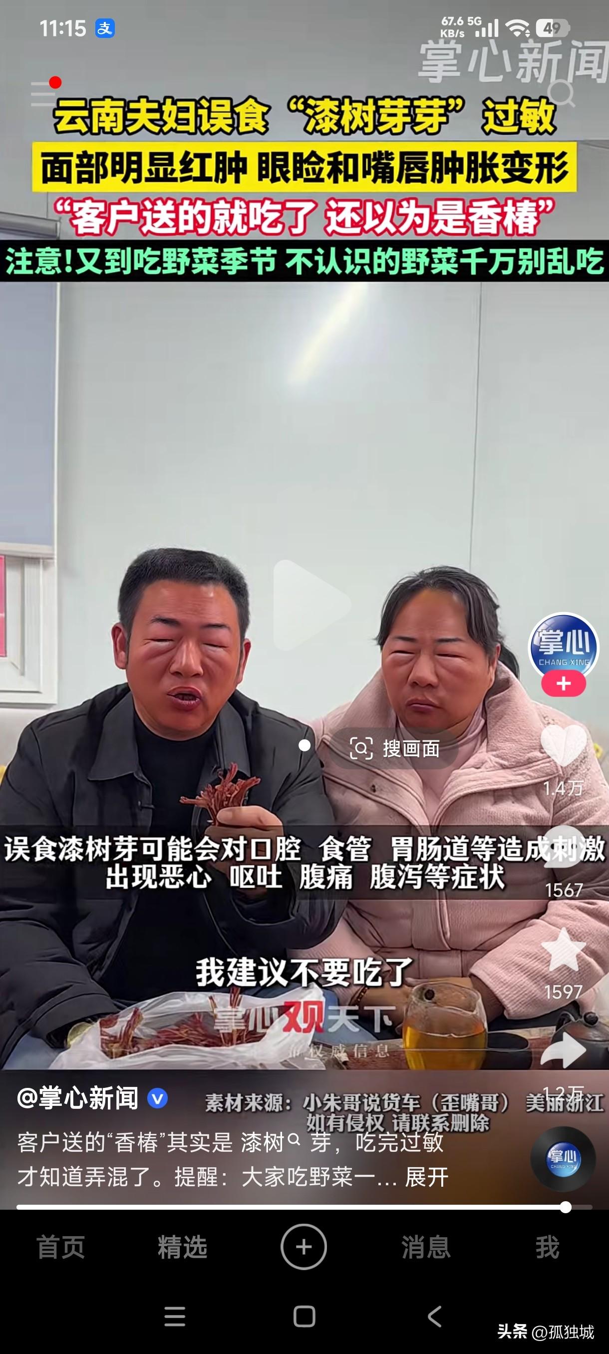 不认识香椿的人还是不要吃了吧……
云南一对夫妇吃了客户送的香椿芽后整个面部包括嘴