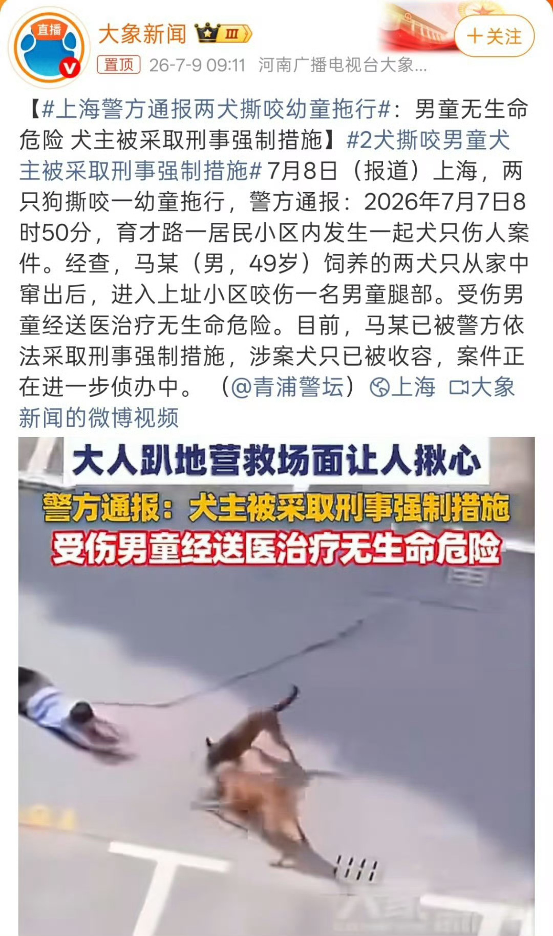 女子遭大狗撕咬20秒狂犬病三级暴露昨天有个咬孩子的，直接采取刑事强制措施了，这怎