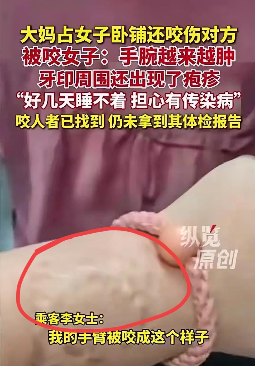 这大妈那一嘴下去，咬的可不仅仅是人，是把自己后半辈子的安生日子全给咬碎了。

医