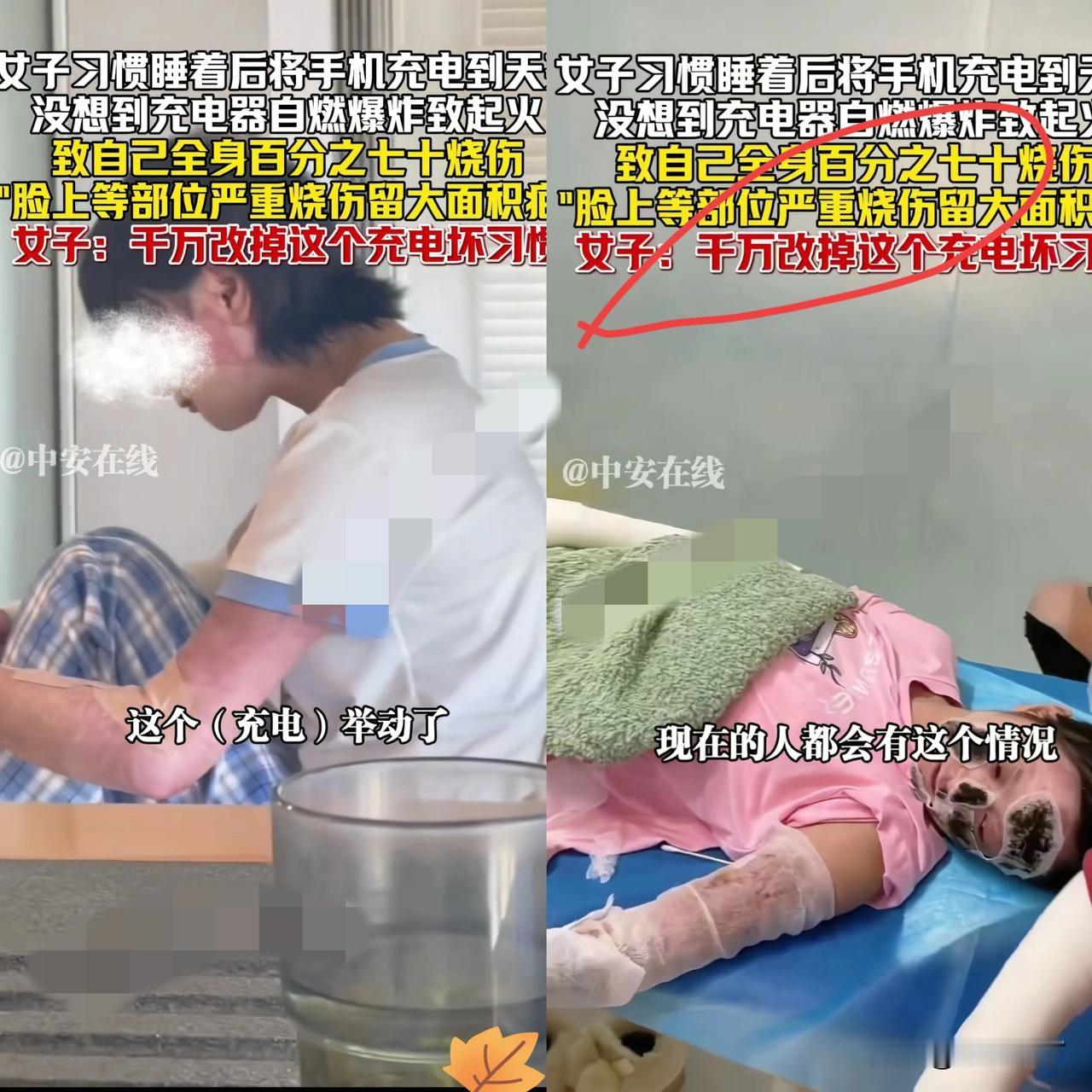 有这习惯的要注意了！
湖北一女子睡前把手机搁床边通宵充电，睡梦中一声巨响，手机突