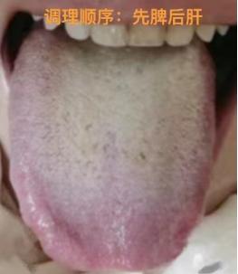 房市不行，宗筋无力，时间短。这次要讲的患者，主要是功能方面出现了问题，宗筋疲软，