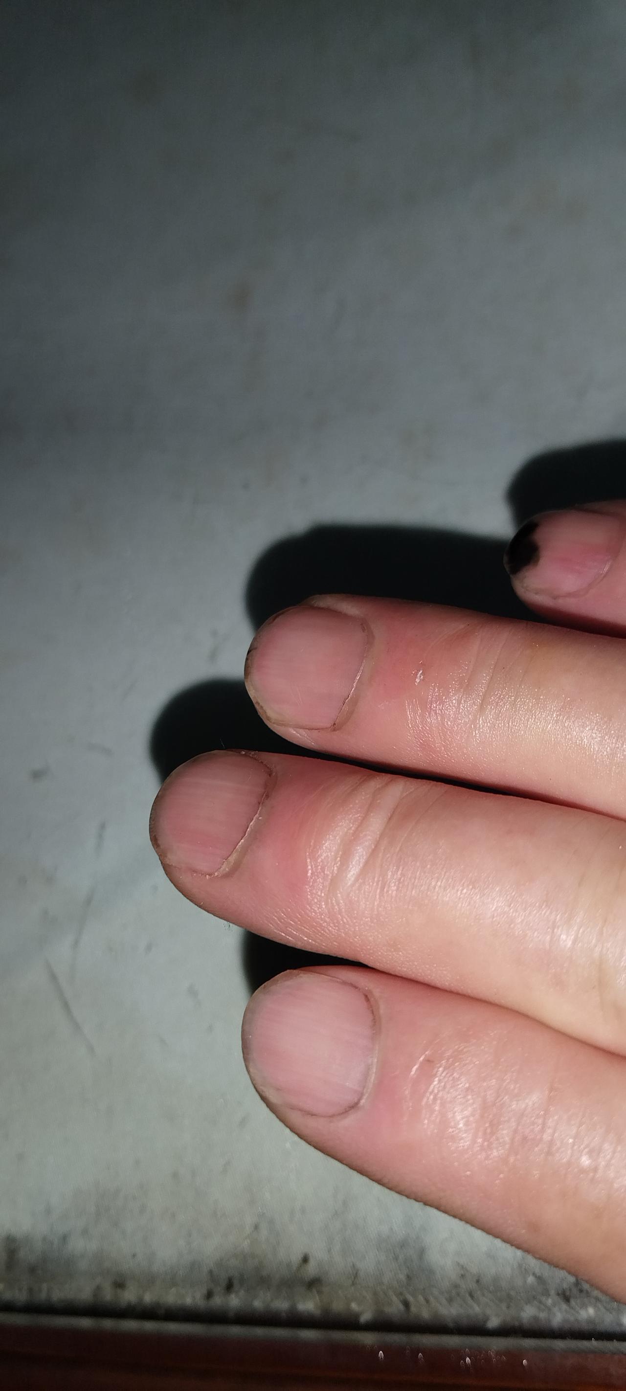 作者观察的很仔细，但这不能说明什么！这是光线的问题，照片上我的小指黑色的部分，是