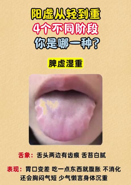 阳虚从轻到重 4 个不同阶段，你是哪一种？