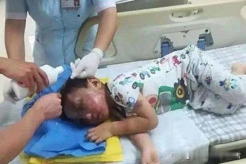 这事儿真的让人恨到发抖！福建12岁女孩琪琪，被生父和继母虐得太惨了。生父居然亲手