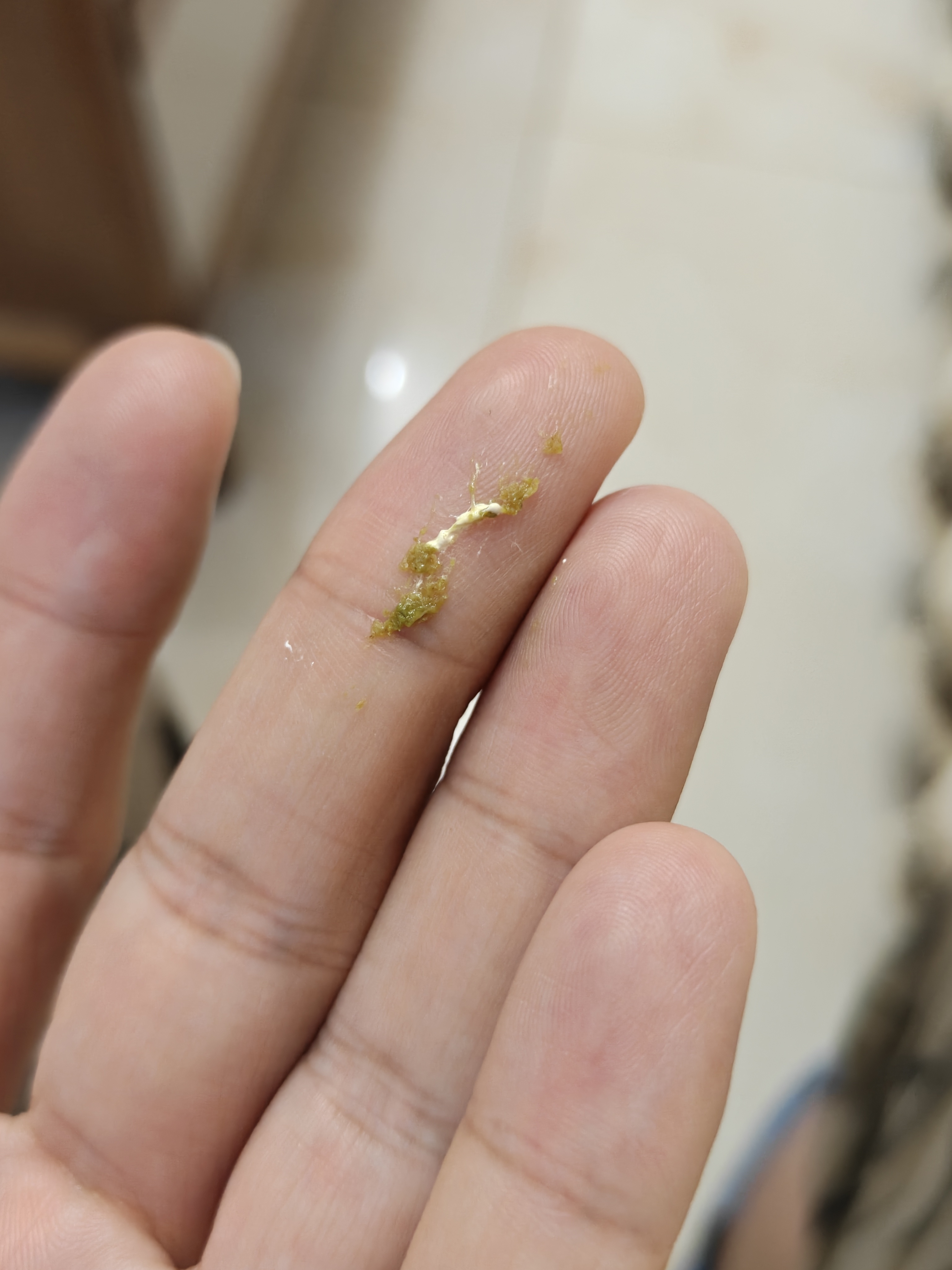 俩鸟站在我肩膀上，从左边走到右边，右边走道左边。。。突然感觉不对劲，脖子上有个湿
