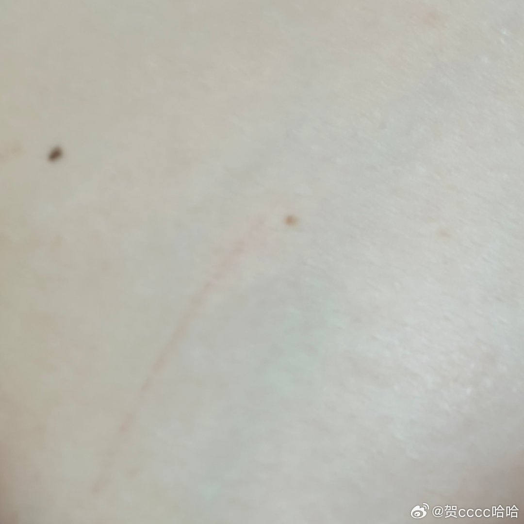 他挠我
