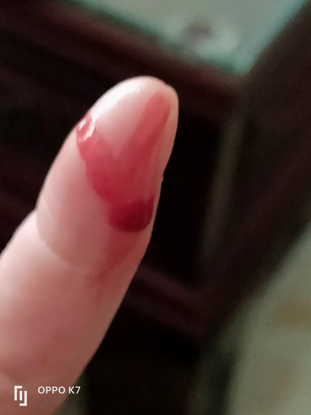 #分享一张你最近随手拍的照片吧#老公最近买了测血糖的仪器，我一直都没有测过血糖，