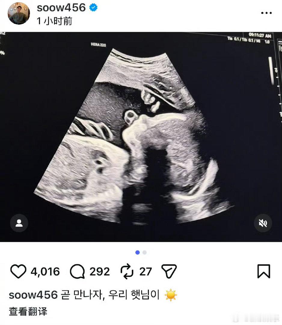 宋承炫当爸宋承炫老婆怀孕 21日，前FTISLAND成员宋承炫晒宝宝B超照，宣布