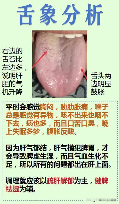 【舌象分析】

免费帮大家分析舌象，你发我看！

注意拍摄清晰、完整！

#中医