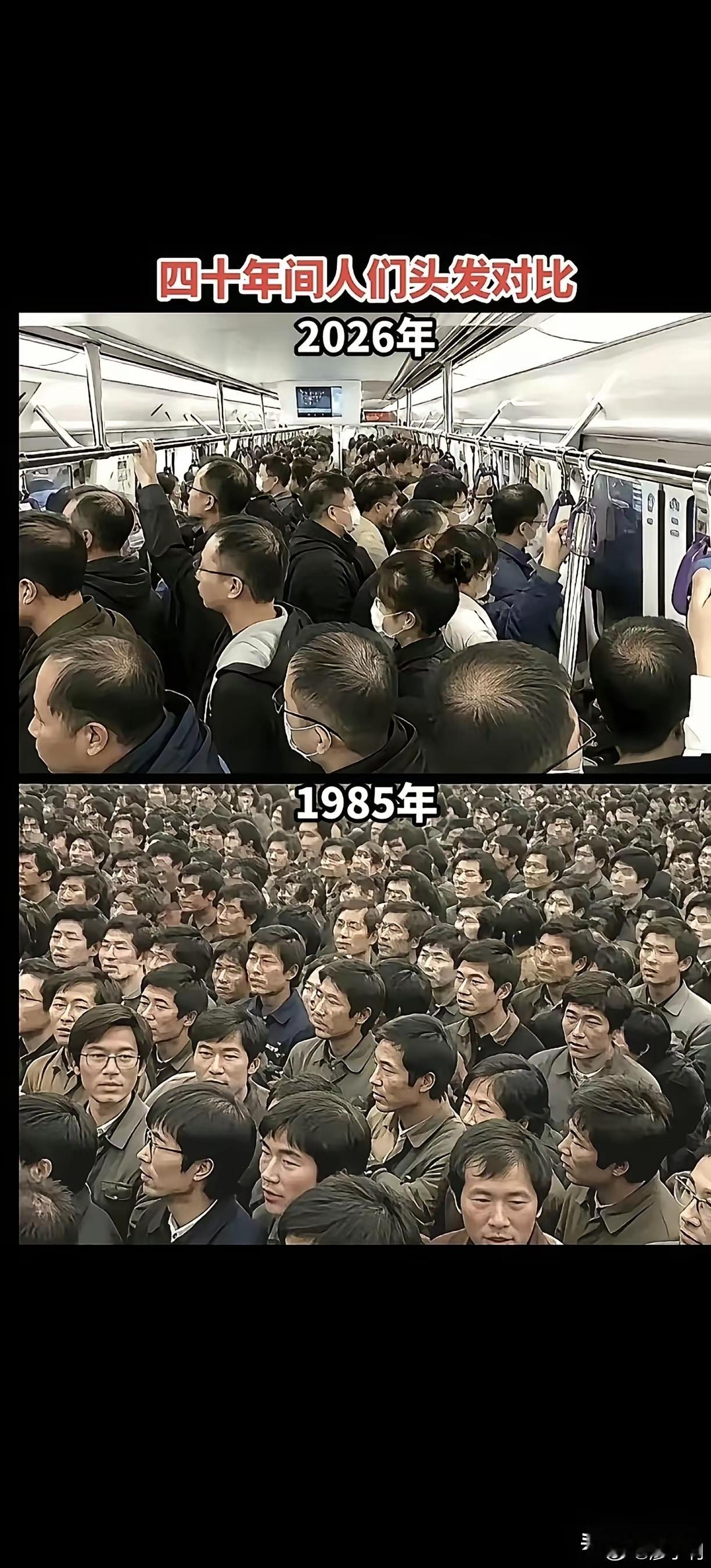 看看七八十年代的人们，头发那么浓密，再看看现在不是脱发就是谢顶！ ​​​