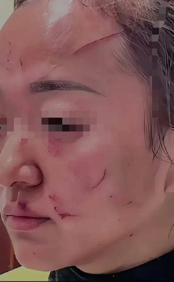 女婿昨天把我女儿打了，原本我满心偏袒自家女儿，听说女婿动手打人，第一反应就是愤怒
