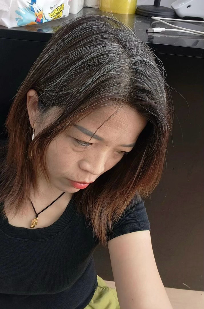 网友分享，她也是80后接近90后的老女人不开心☹️，满头白发，很肥胖，满脸痘痘和