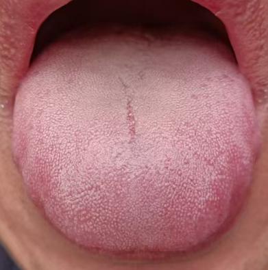 精力不足、状态不佳？中医教你这样调理







顽固性的往事不兴旺该如何调理