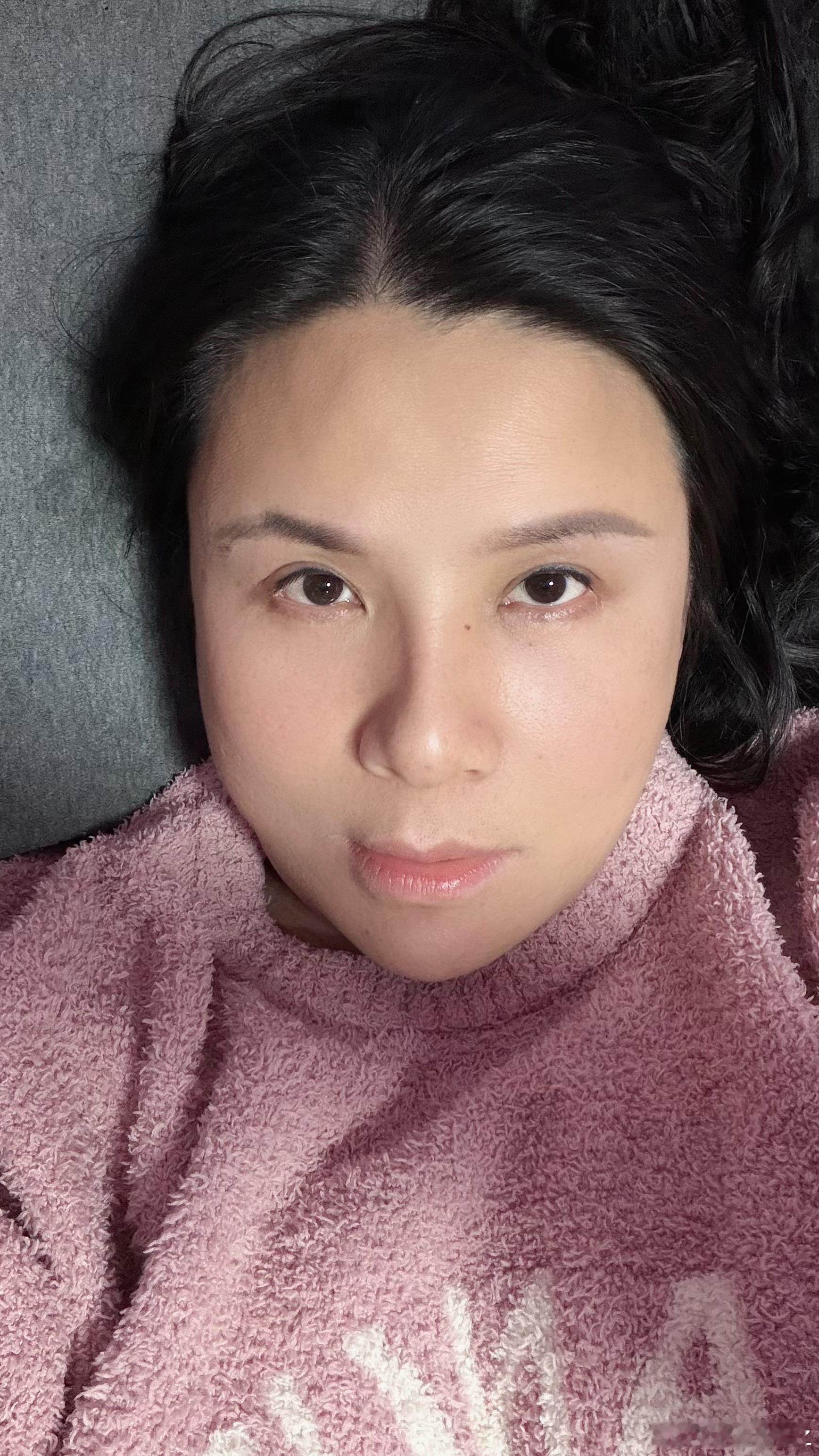 身心平衡会反映在脸上，如今经过系列康复，左侧的张力已经大大下滑，只剩少许不平衡。