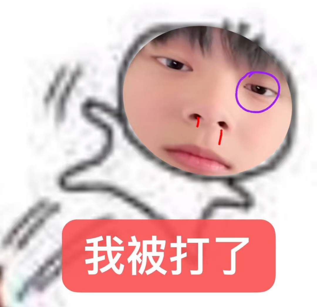 我感觉芒果🥭这个东西肯定上辈子克我，今生，不但芒果过敏，心肝还被芒果精和芒果丝
