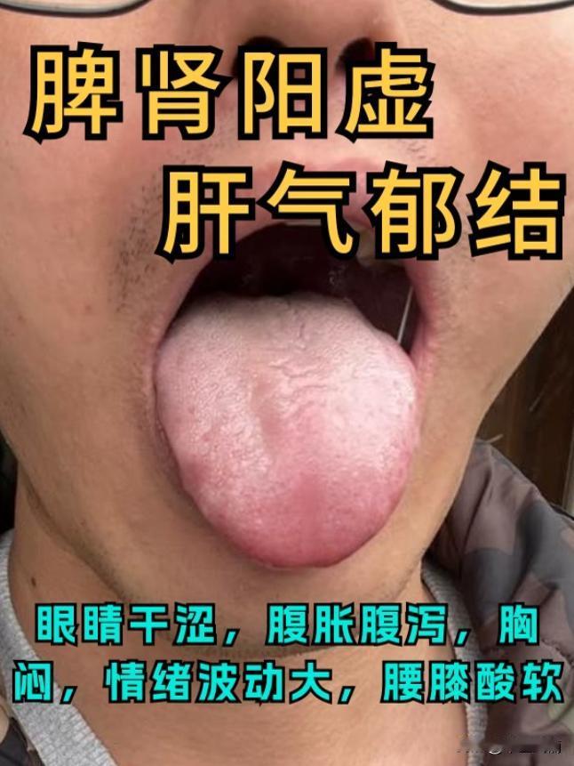 脾肾阳虚，肝气郁结，肝郁化热