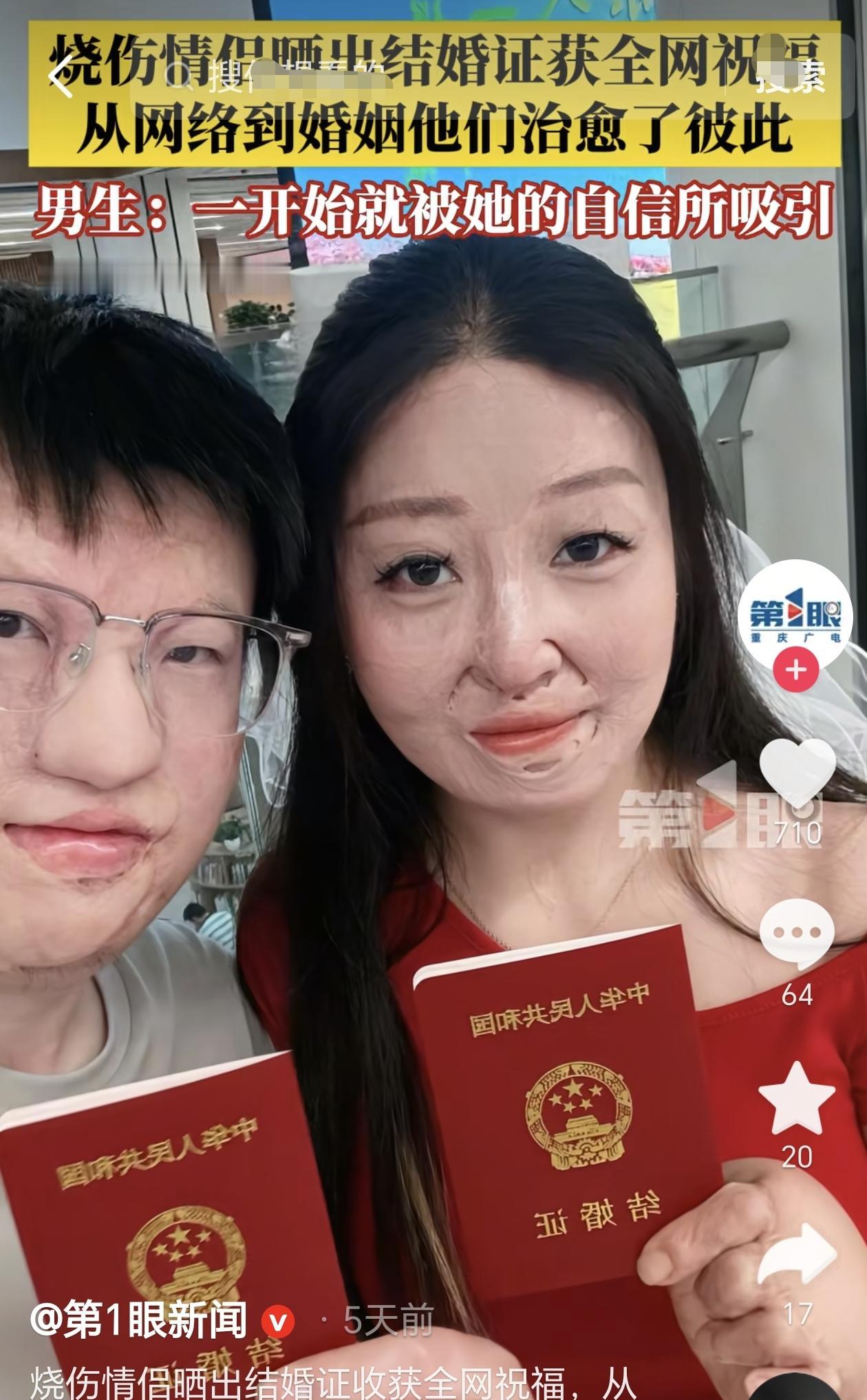 浙江杭州，有一对烧伤情侣在网上晒出结婚证，没想到他们竟然得到全网祝福，他们从网络