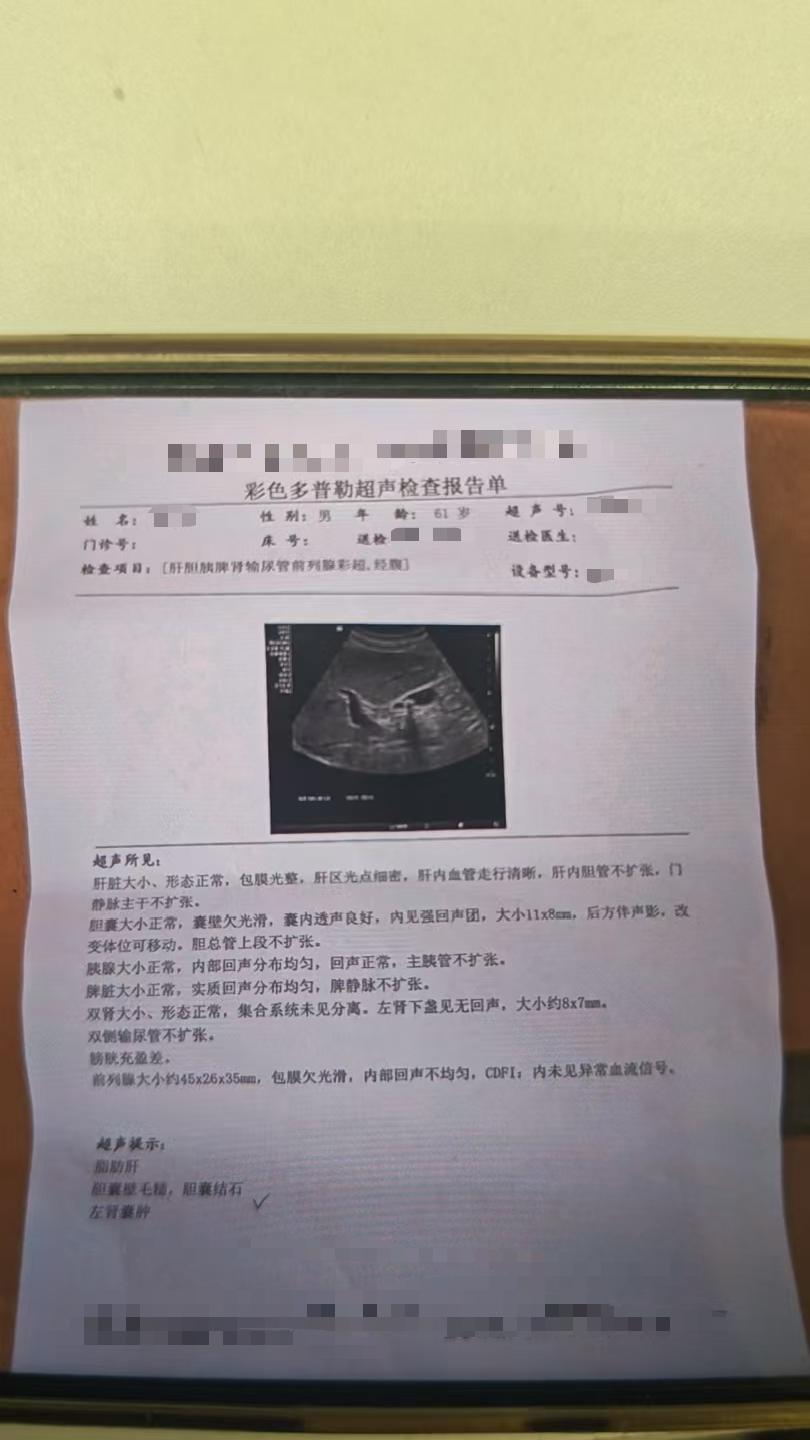 胆结石别害怕，简单3个小药片。成本只要几毛钱。很多人查出胆结石，每天忧...