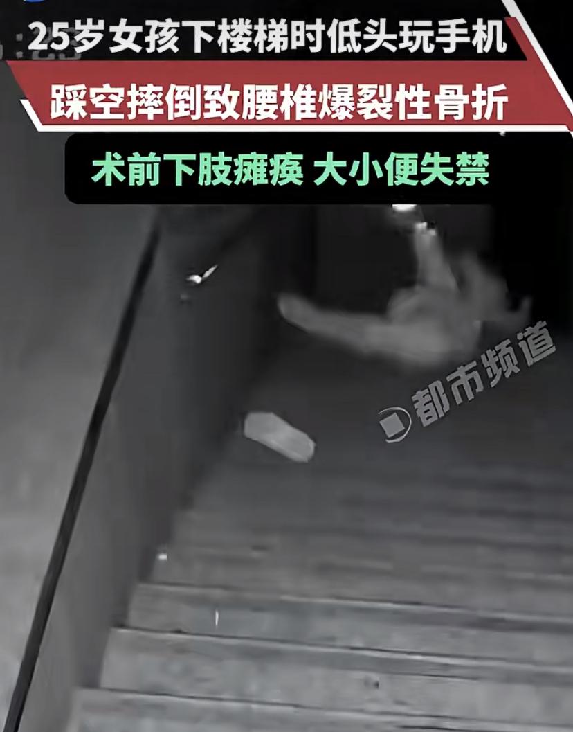25岁女孩下楼时一直低头刷手机，一脚踩空摔下楼梯，腰椎当场爆裂!人送到医院时，下