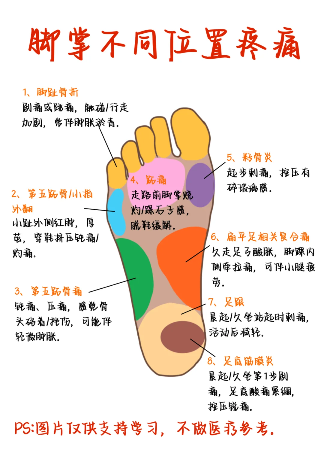 医学生笔记——脚掌不同位置疼痛