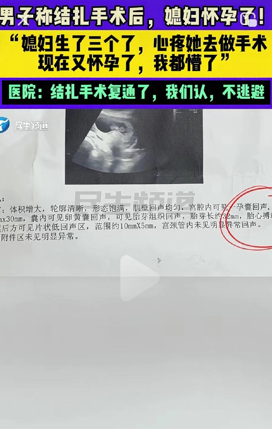 结扎后妻子又怀了？河南一位心疼媳妇生了三胎的丈夫，特意去做了结扎手术。没想到，手