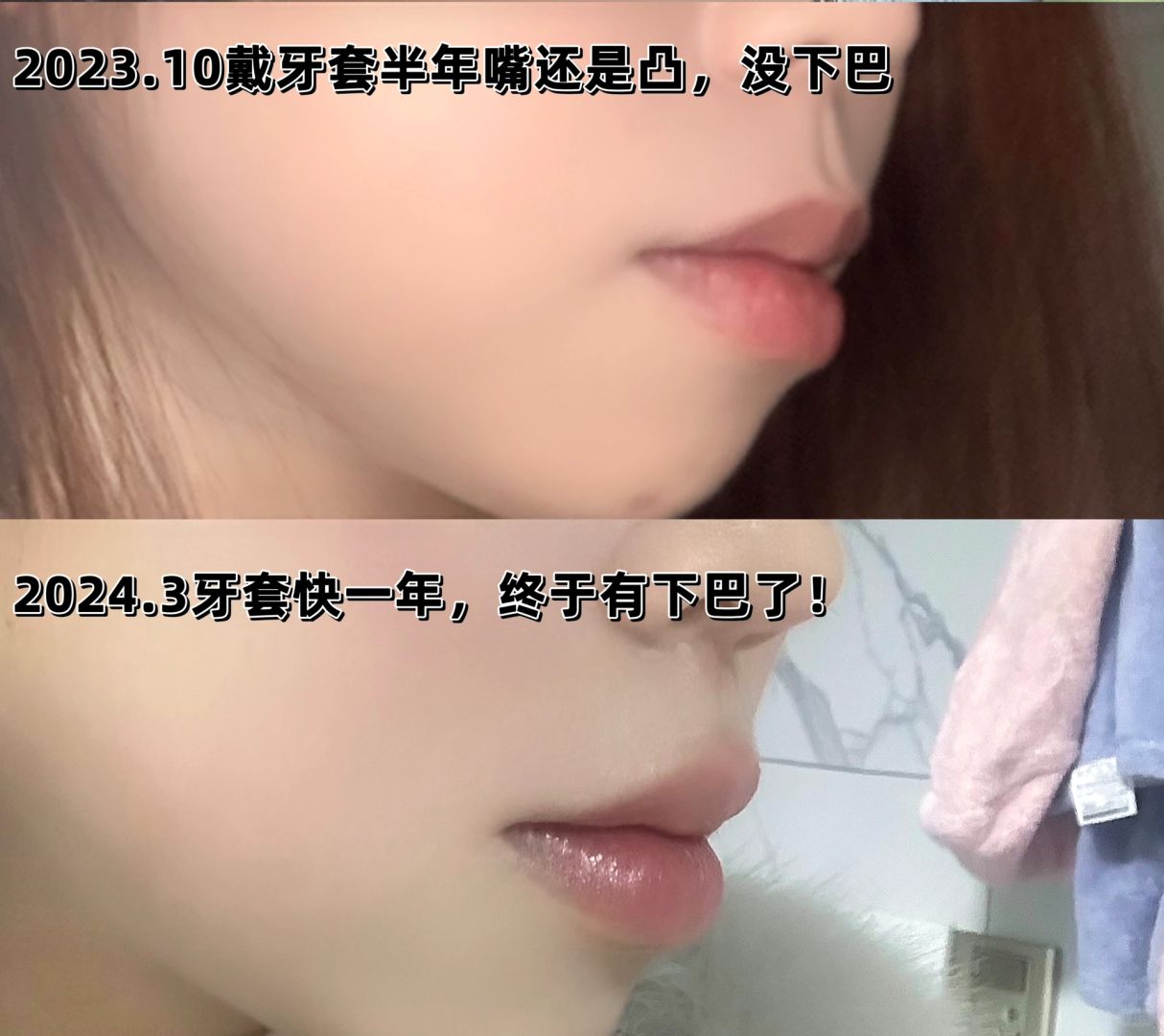 公主请看 ！正畸好用物软件版