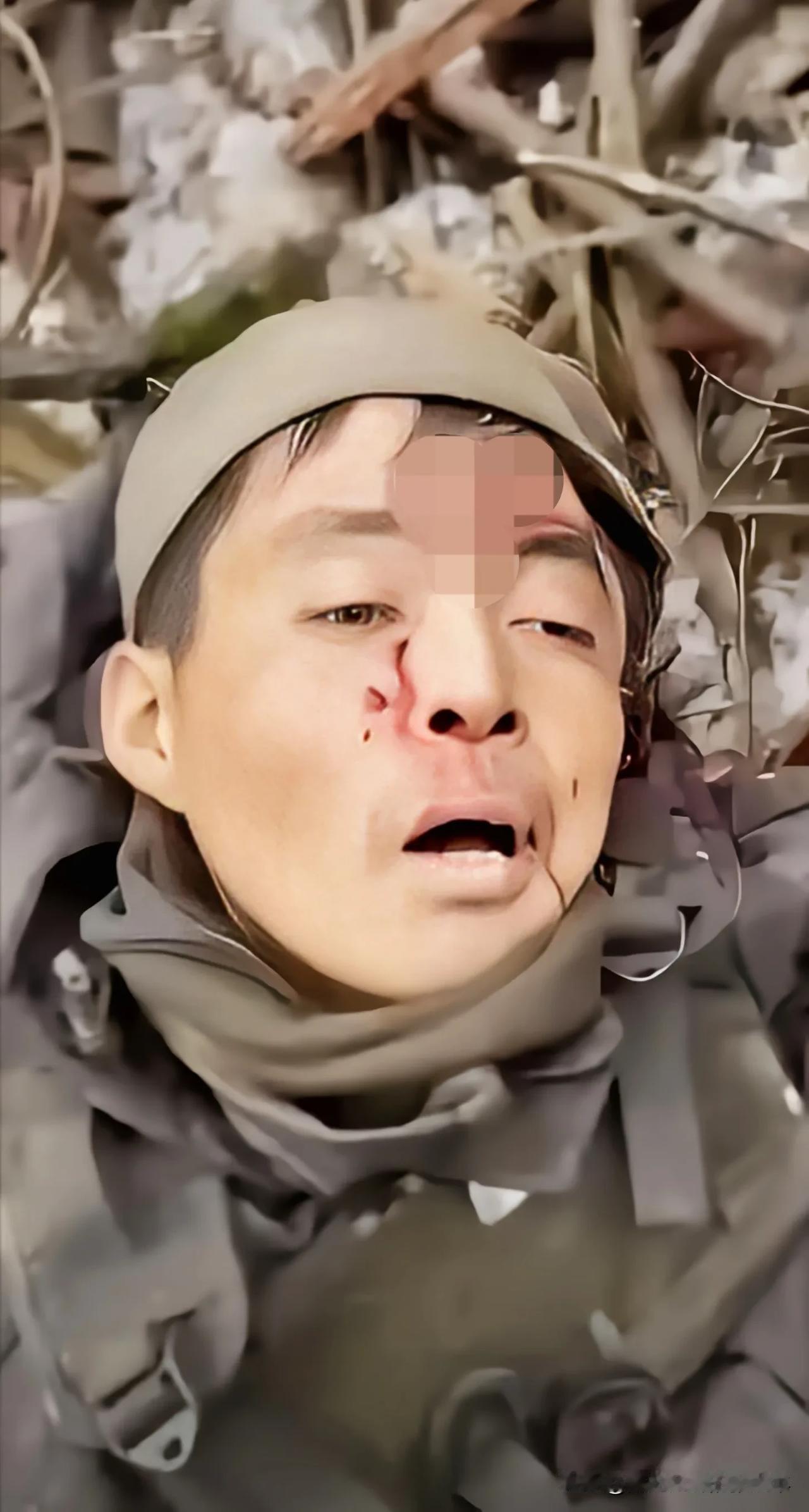 乌克兰在库尔斯克正在与俄朝联军浴血鏖战 ……

战场有多惨烈，这图片可见一斑。