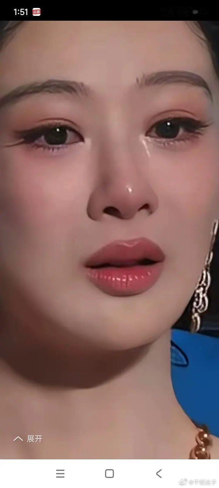 杨紫下嘴唇好多竖线是怎么回事 