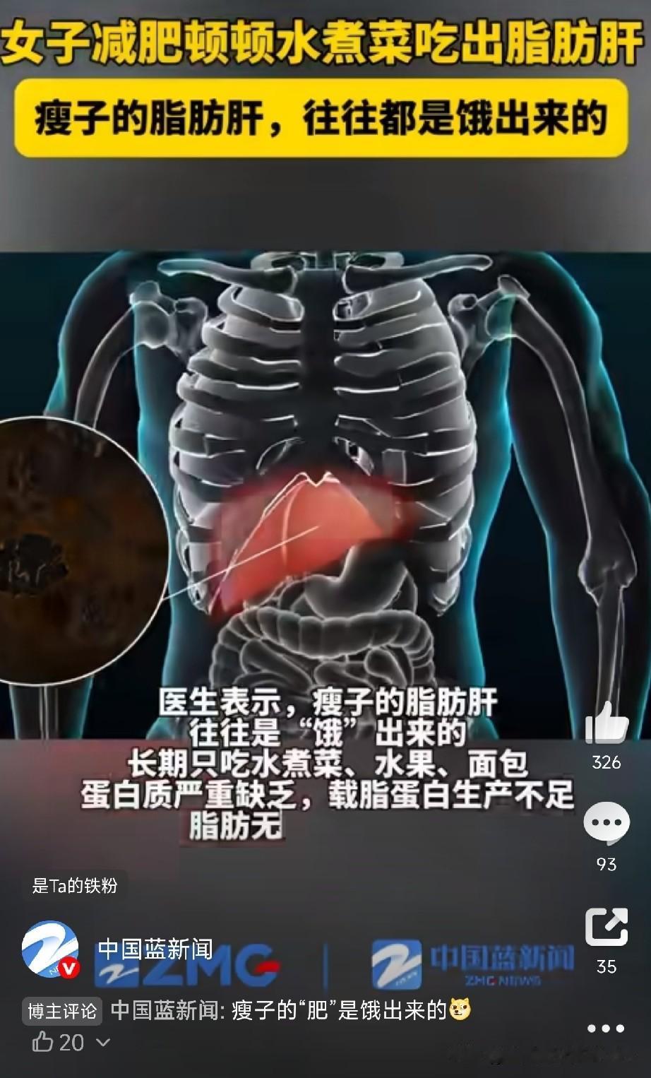 顿顿水煮菜，瘦了却查出脂肪肝！医生说这是“饿”出来的病

杭州40岁的徐女士，为