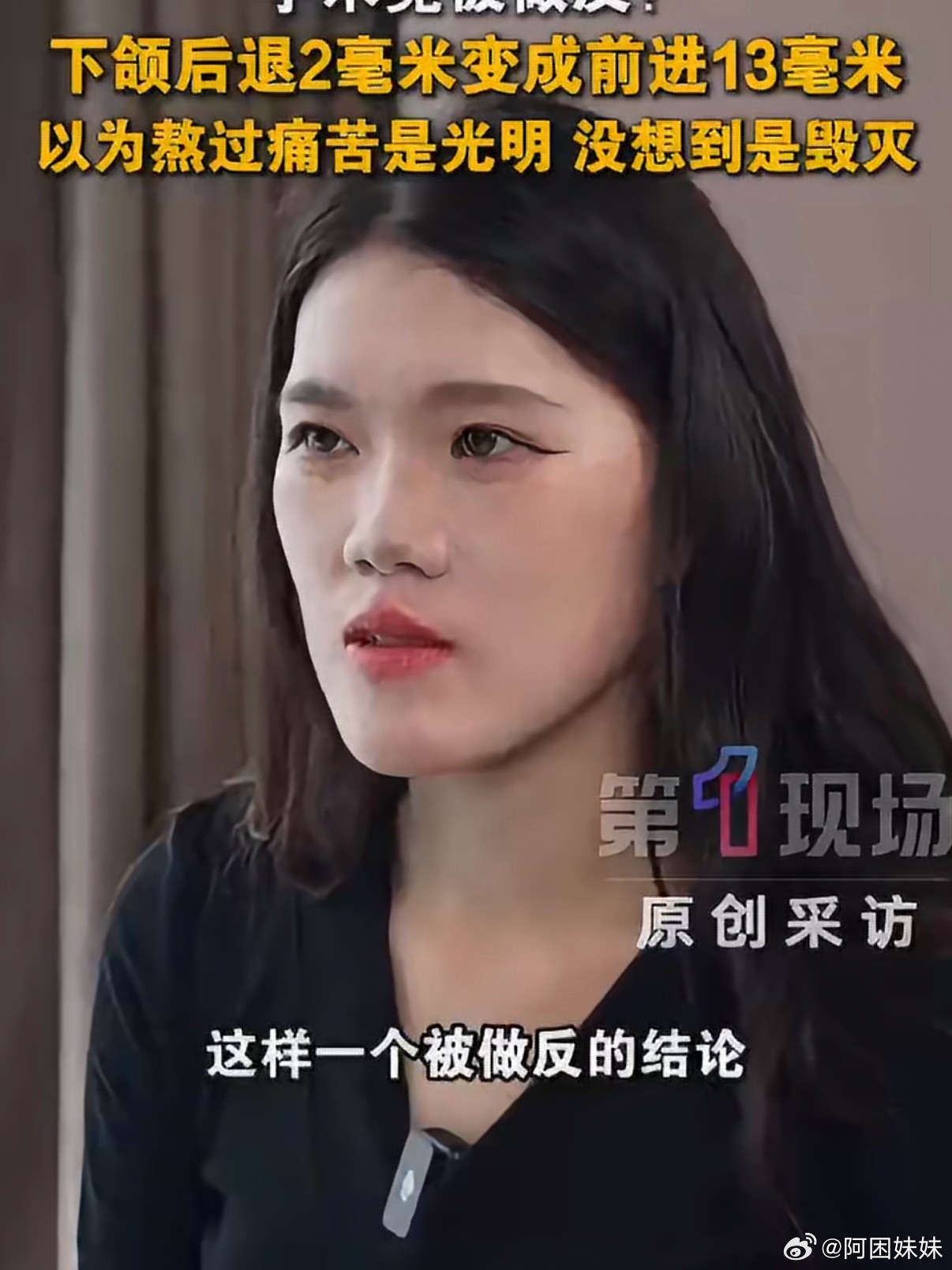 我还想去做正颌整牙来着，但是正颌手术可痛苦了，尤其是术后长达半月不能正常吃饭，消