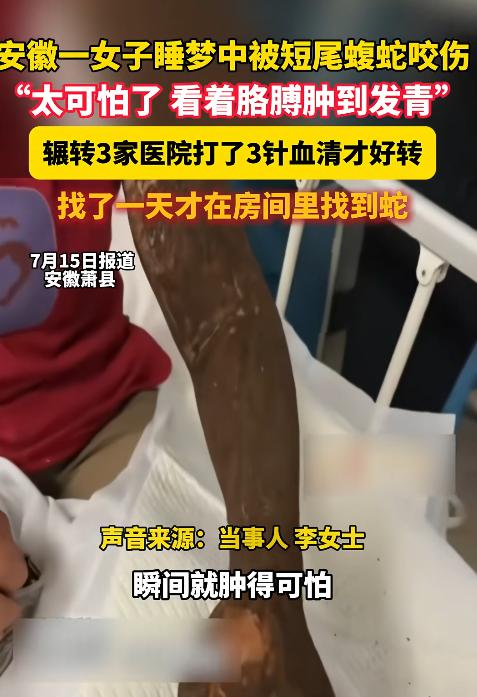 防不胜防！安徽萧县，一名女子在家熟睡时突然被剧痛惊醒，抬手发现胳膊上多了两个小伤