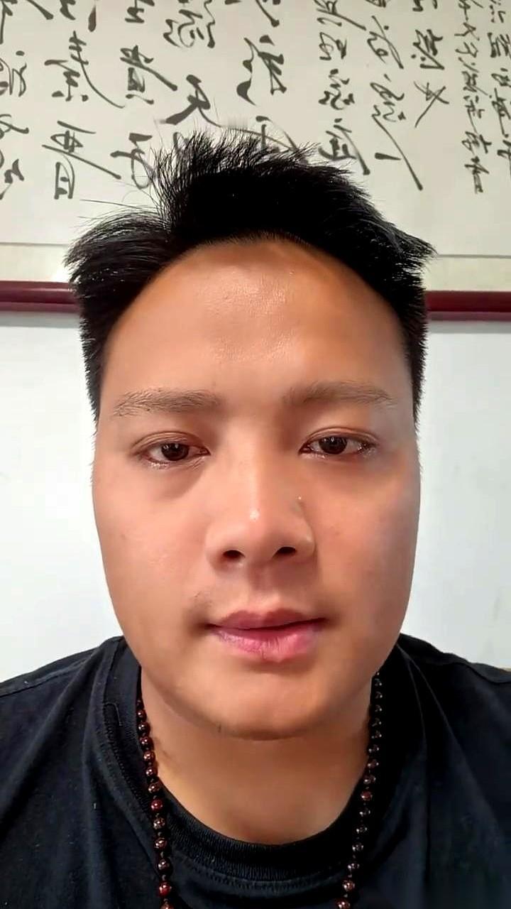 你是不是也觉得，鼻梁上那颗小痣，是点睛之笔？显得人又俏皮又娇媚。
我一侄女就这么