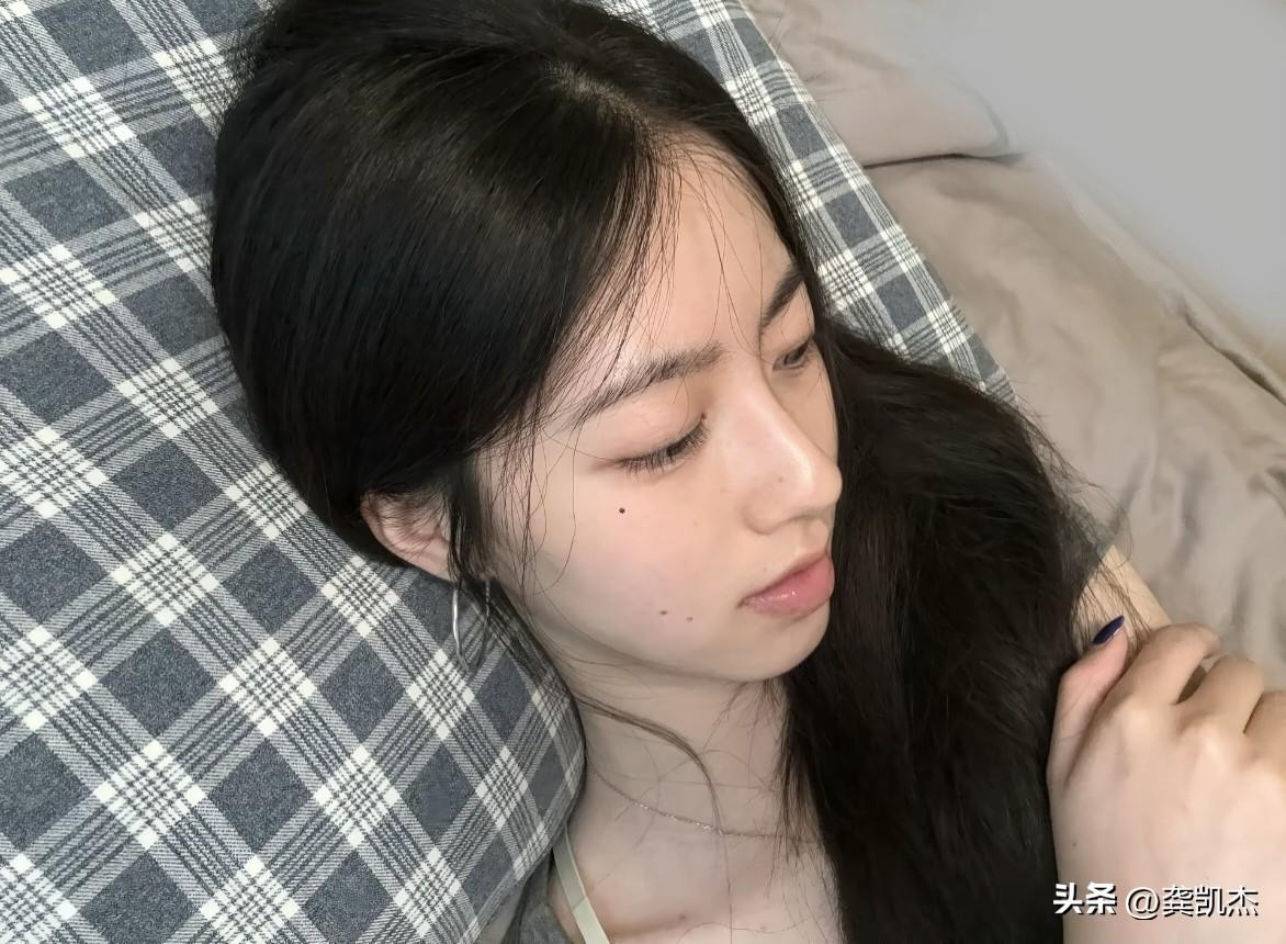 脸上的痣影响颜值吗？实话实说。