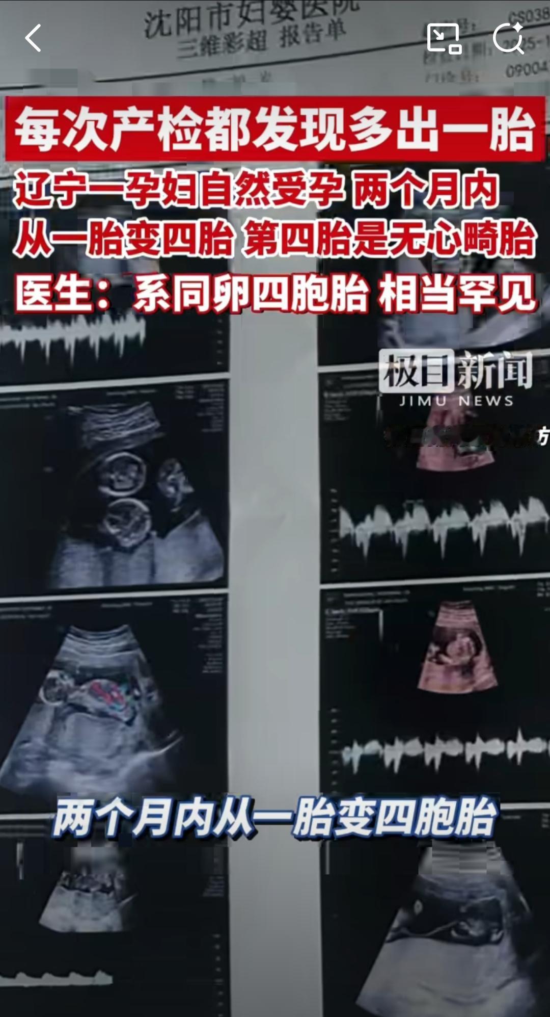 辽宁抚顺一位30岁的王女士，最近的怀孕经历让不少人又惊又忧，她自然受孕后短短两个