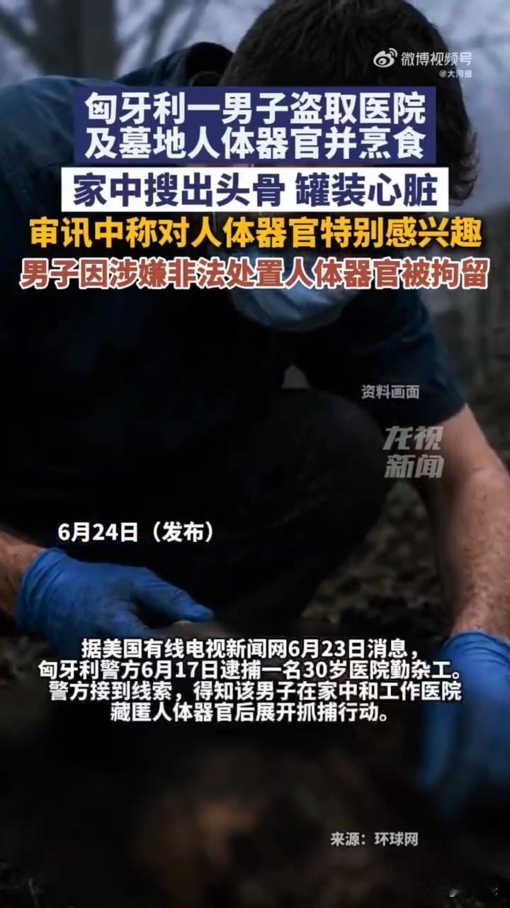 太吓人了！这也能下得去嘴？看着新闻我隔着屏幕都有点恶心！

据悉，匈牙利一名30