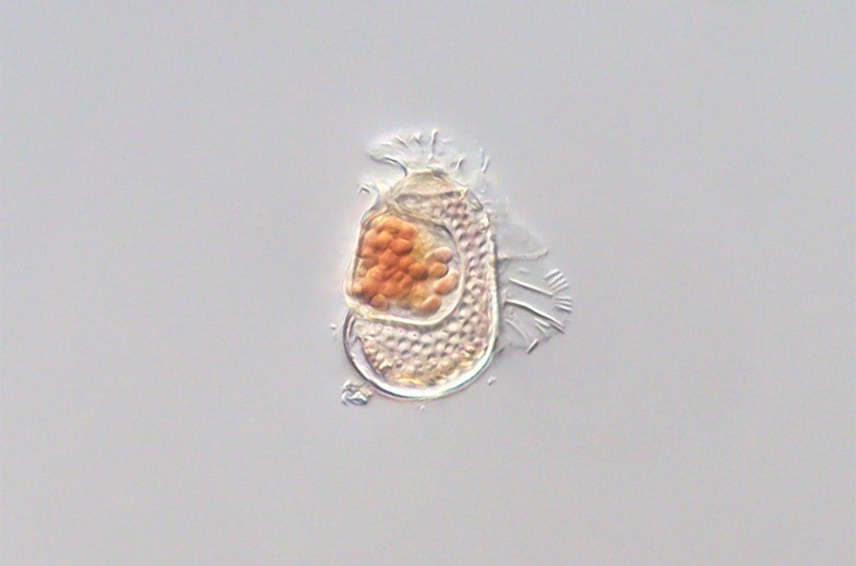 带有奇异基因组的微生物或正演化为病毒

研究人员在一种名为Citharistes