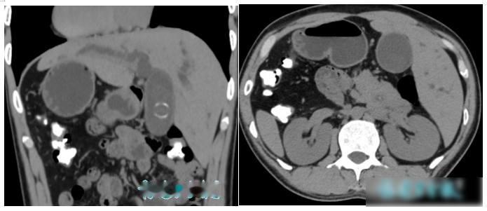 罕见！福建发现1例“镜面人”，医生：全球仅百万分之一
你能想象吗？有人心脏长在右