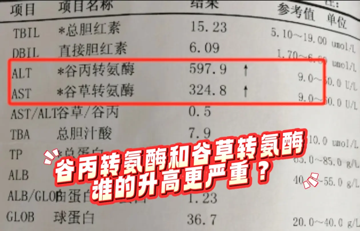 谷丙转氨酶和谷草转氨酶，哪个升高更严重？ 谷丙转氨酶主要活动于肝细胞浆...