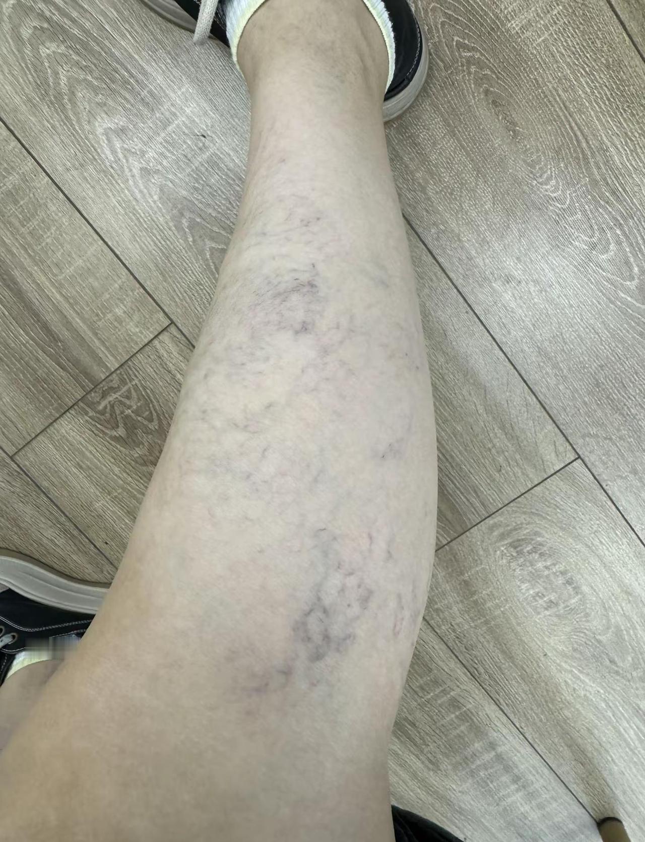 我滴个腿呀！这坑腿费嗓浓脑子的，