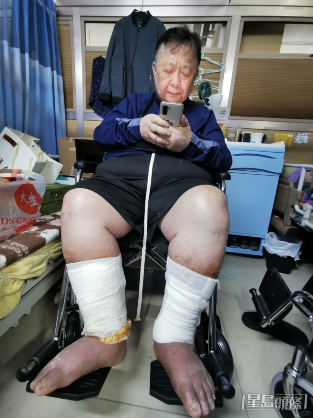 76岁秦煌脚肿到发黑，住护老院被投诉不睡觉