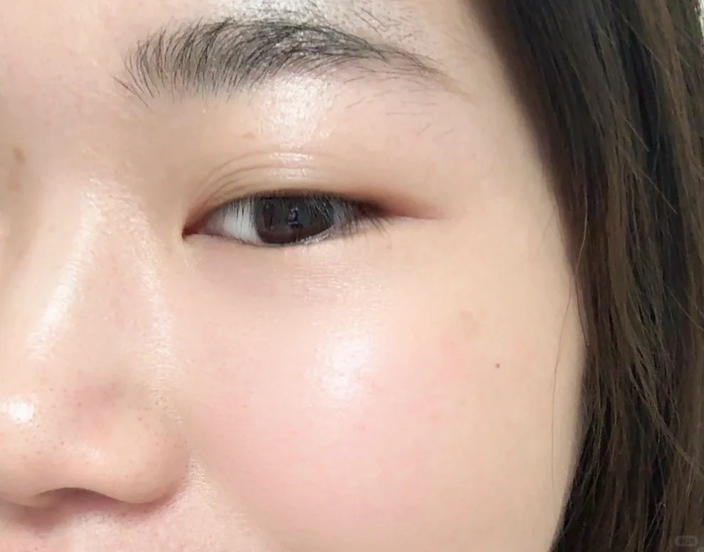 去黑眼圈真的有点炸裂…