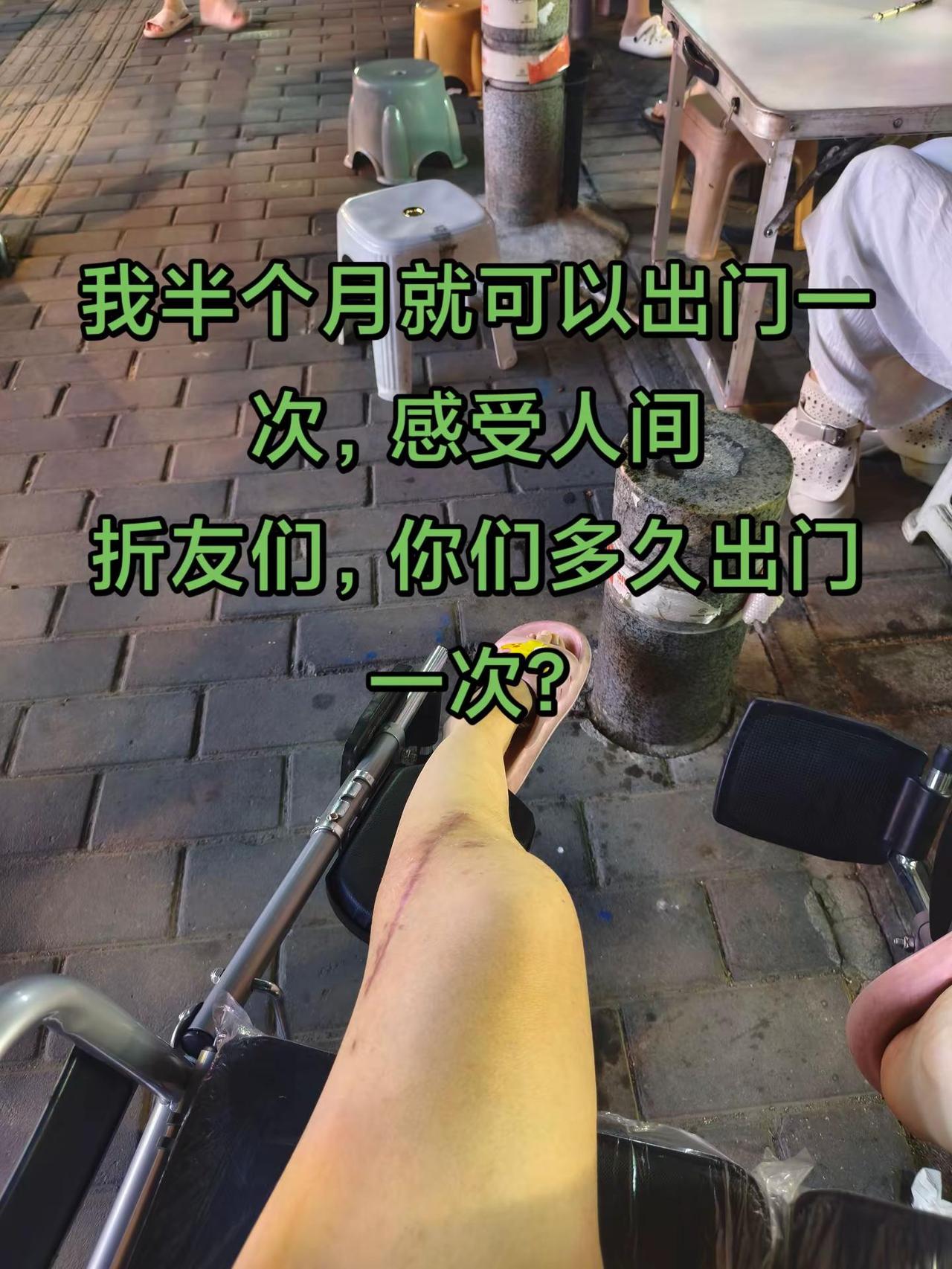 50几天了，依然是一个姿势几分钟就难受，必须不停的换位置换高度换姿势，恢复过程感