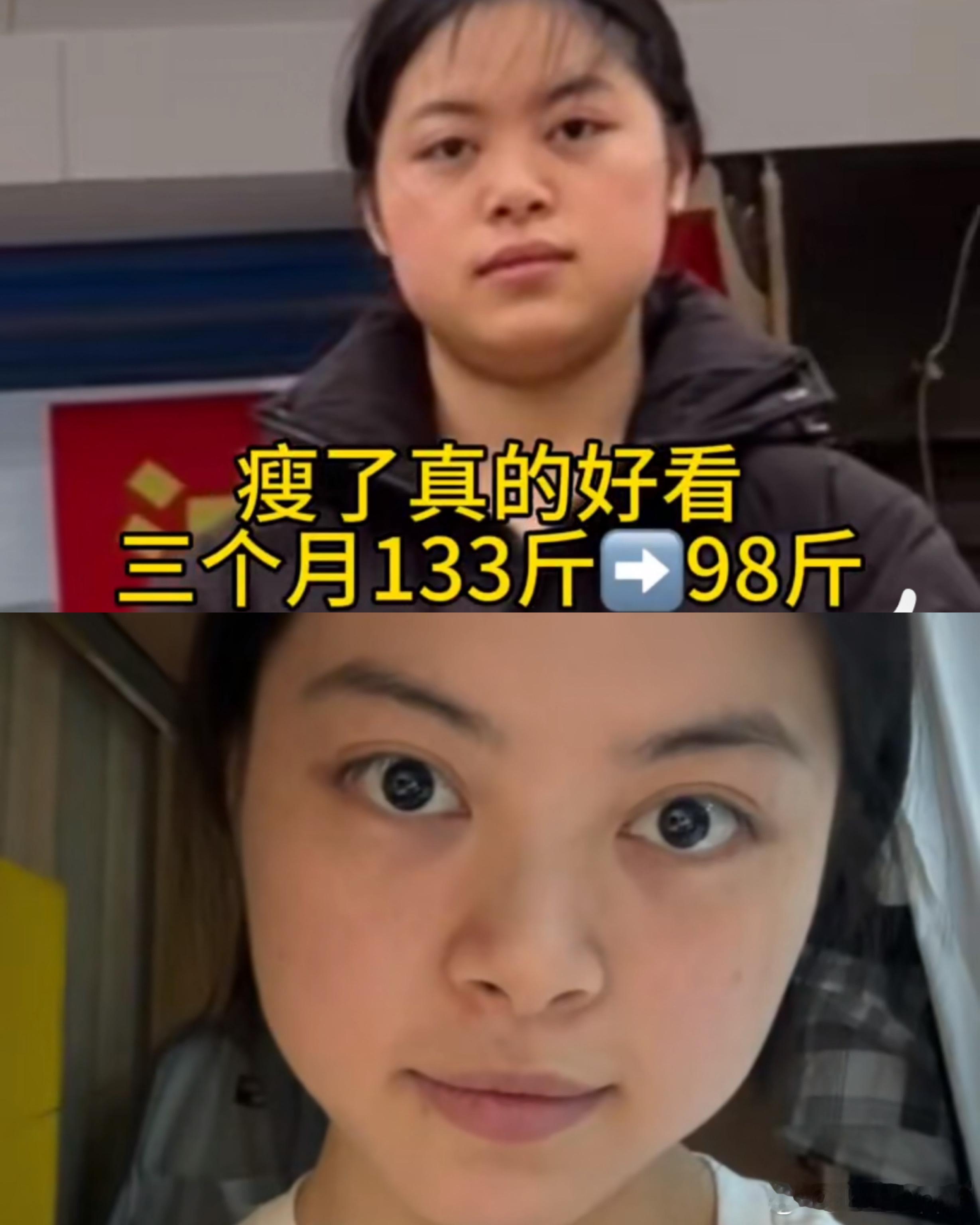 方圆脸瘦了35斤的面部变化变化好明显！皮肤变好了 眼睛也变大了 整个人精神了很多