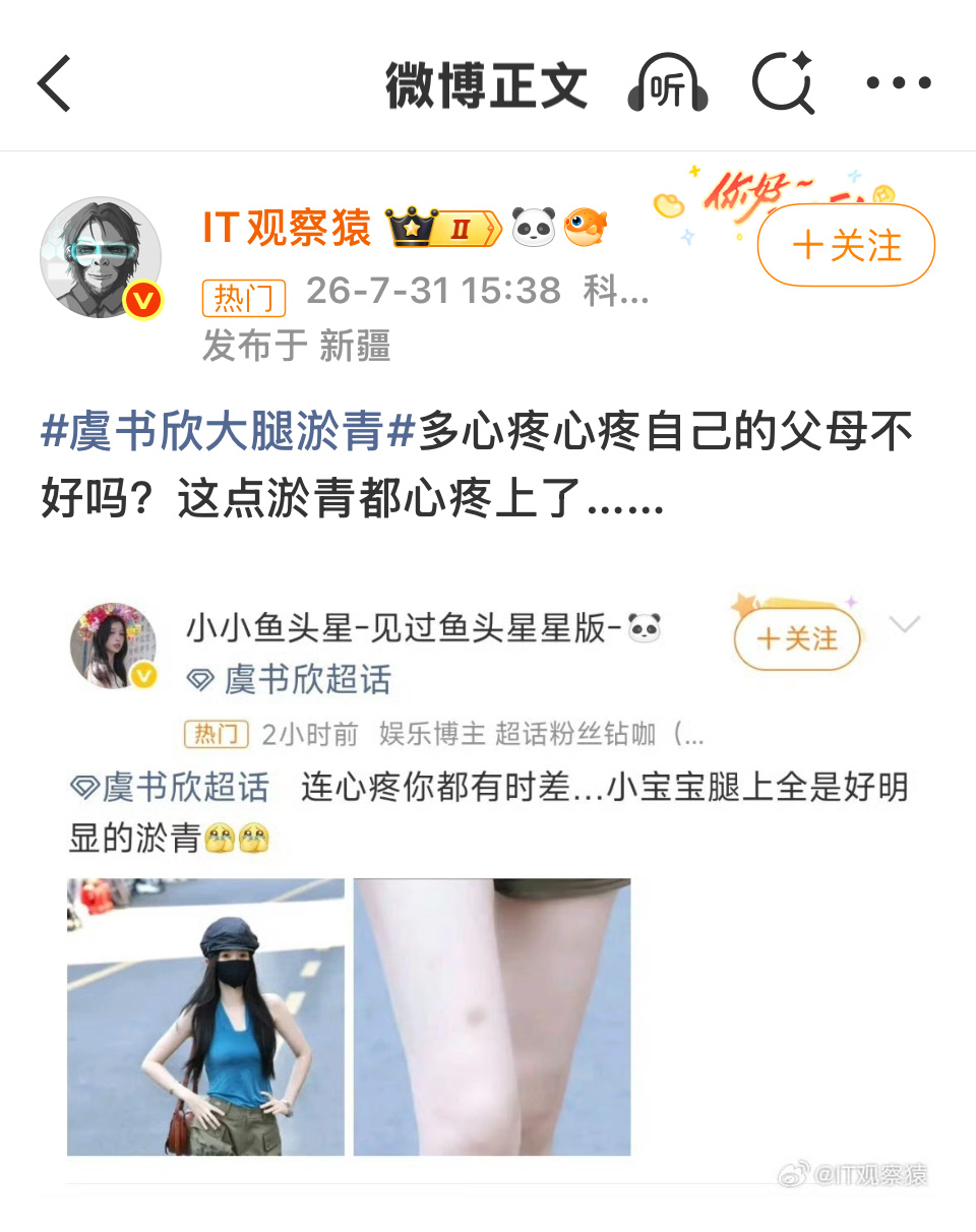 想笑虞书欣大腿淤青
