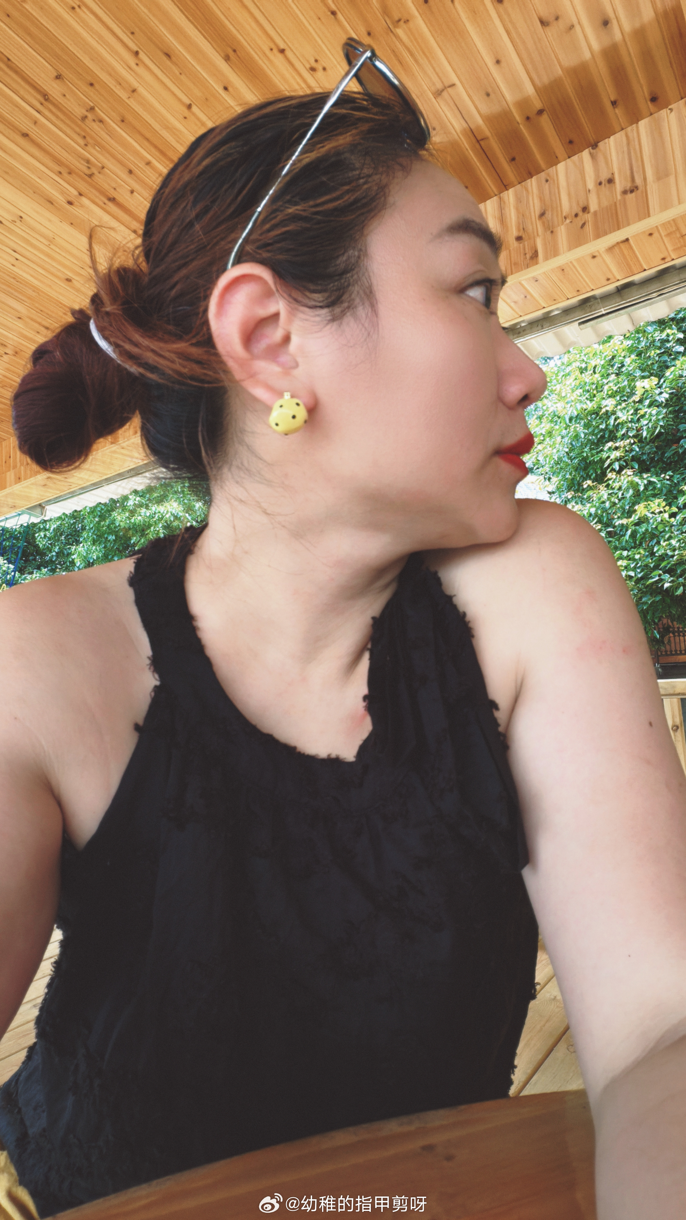 美丽的女人啊～你什么时候能瘦点 鄂州