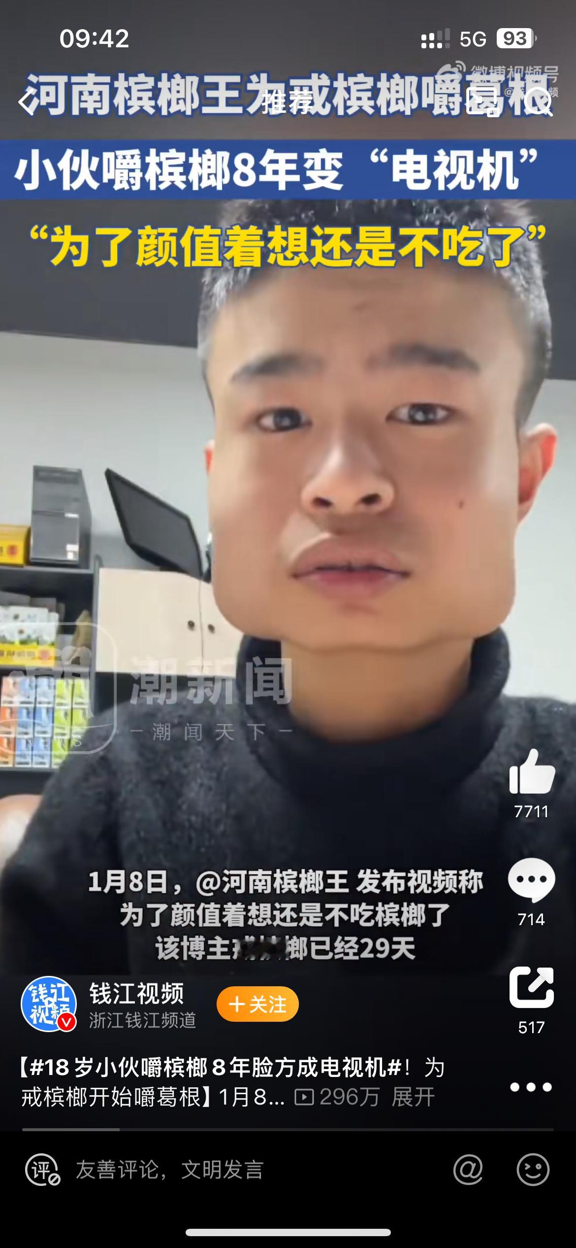 18岁小伙嚼槟榔8年脸方成电视机 这就真的标准的国字脸啊，你换别的东西嚼也恢复不
