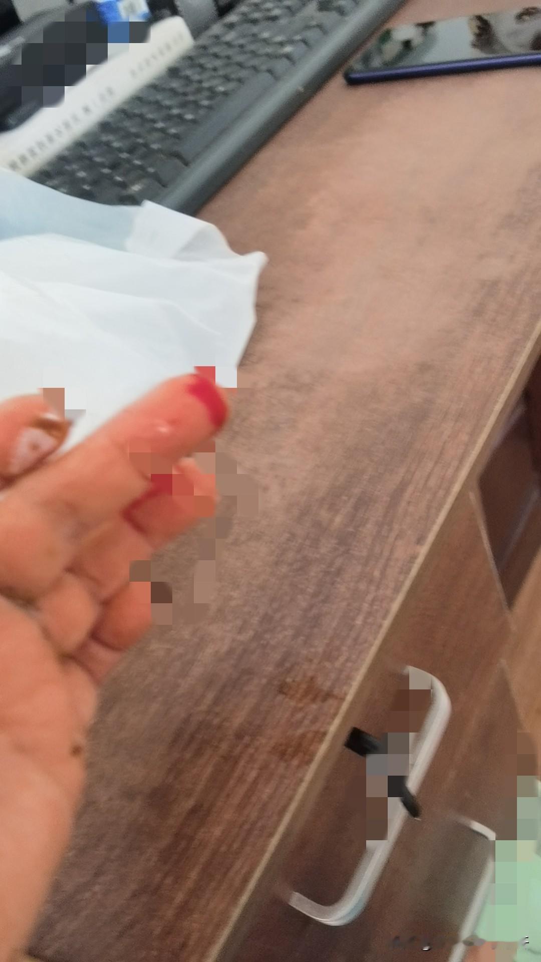 收拾了两天屋子，已经英勇负伤

到家当天看着半年多没回的家，怎么有种破败的感觉，