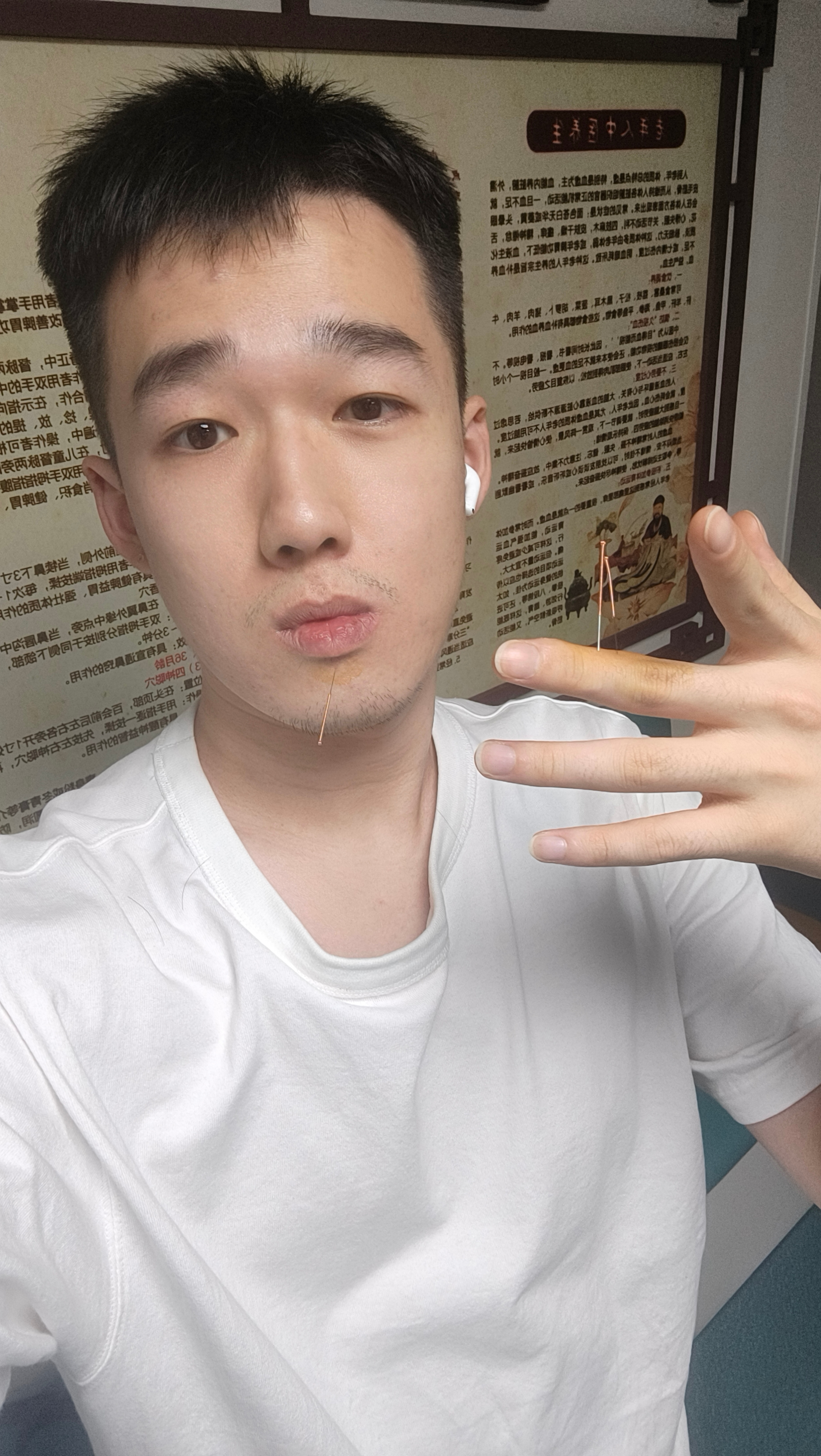 颈椎不舒服扎针灸扎的手[允悲] ​​​