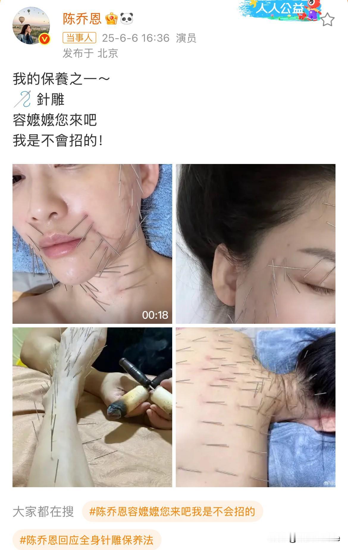 6月6日，我发现，陈乔恩是个狠人！
陈乔恩在线分享保养方法-针雕，满脸满背的针刺